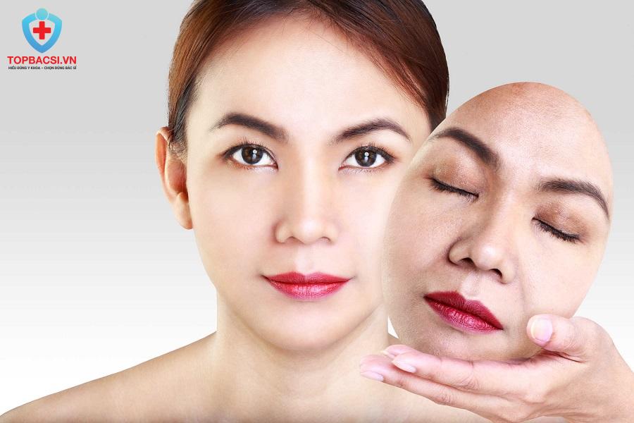 Căng chỉ da mặt: Ưu - Nhược Điểm, Quy Trình, Kết Quả và Chi Phí