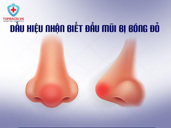 Dấu hiệu nhận biết đầu mũi bị bóng đỏ.