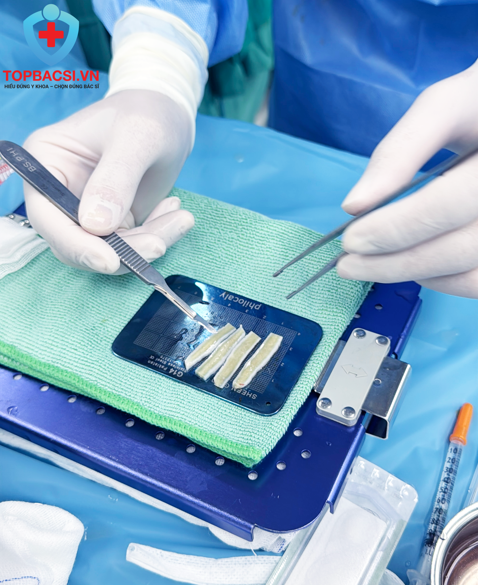 Phần sườn được sử dụng để nâng mũi được vệ sinh chuẩn Y khoa trước khi đưa vào mũi