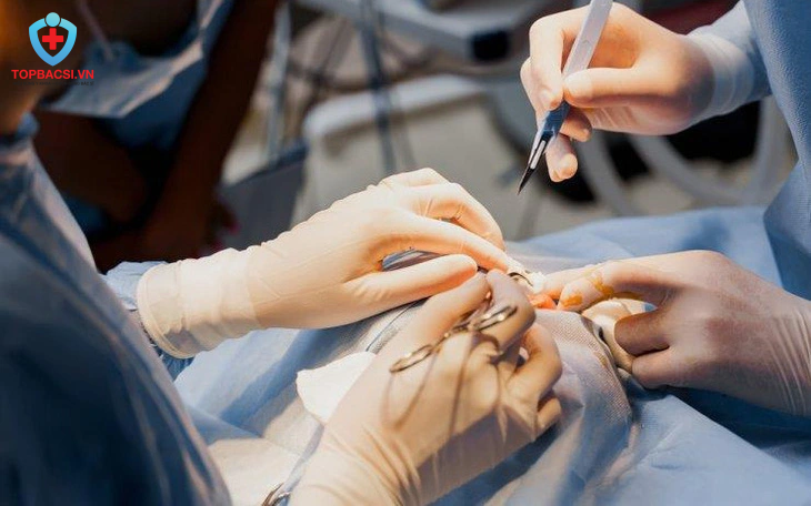 Lý do Việt Kiều chọn về Việt Nam làm thẩm mỹ