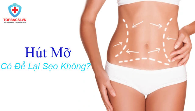 Hút mỡ có để lại sẹo không?