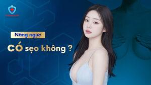 Nâng ngực có sẹo không?